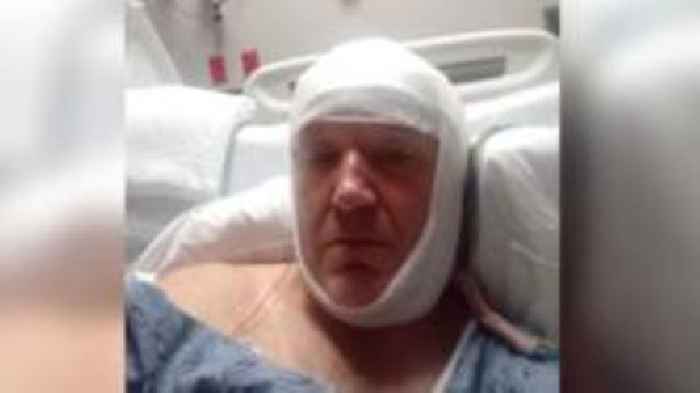 Man 'lucky to be alive' after US building site fall