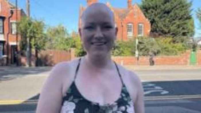 Hairdresser wants to share own alopecia story