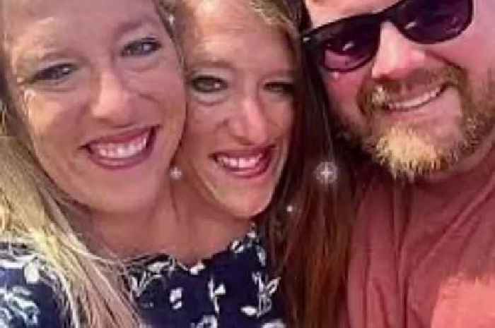 Conjoined twins Abby and Brittany Hensel seen carrying newborn baby