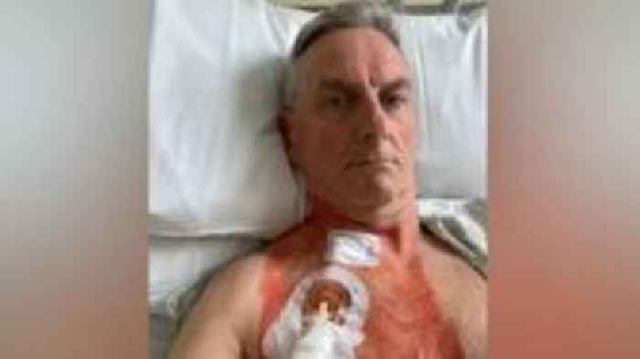 Man thought kidney failure was stomach bug