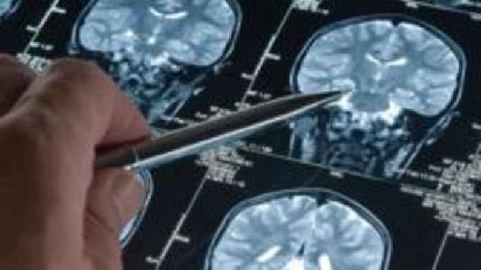Search for 200 volunteers for dementia study