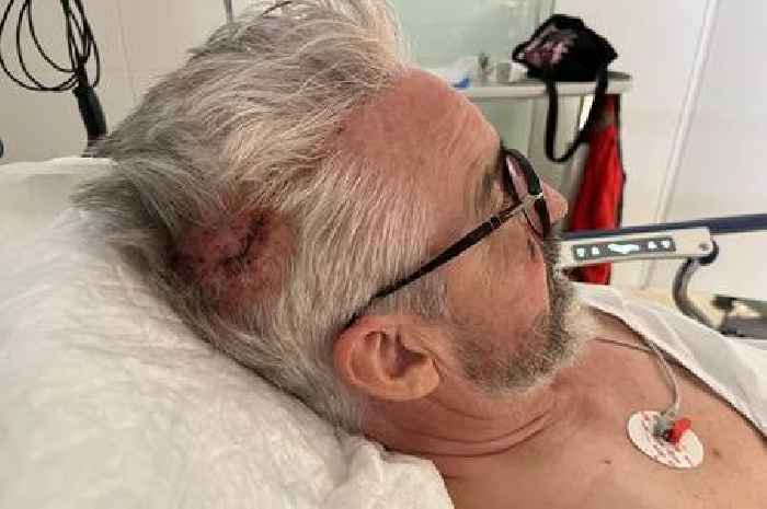 Cyclist could feel warm blood - then 'brain fluid came out of my nose'
