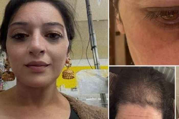 Shopkeeper opens up on brutal attack after violent thief rips hair from scalp