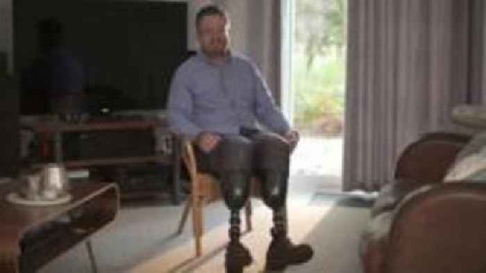 Surgeon admits fraud over amputation of own legs
