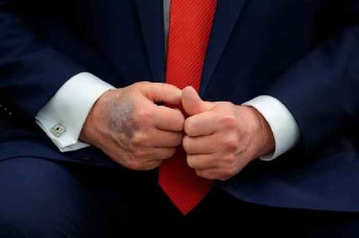 Surgeon says how to tell when a bruise is 'serious' after Trump diagnosis