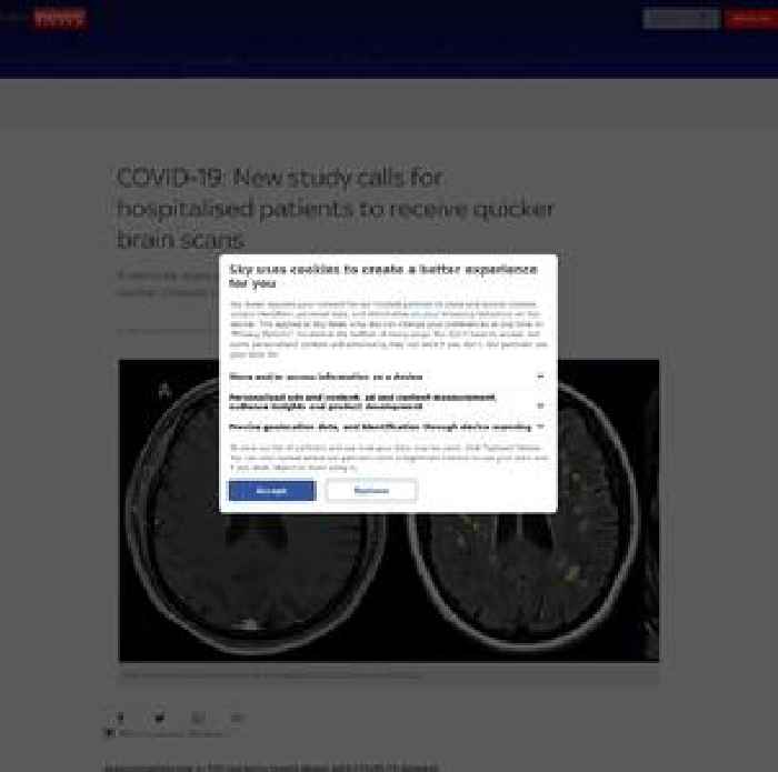 New COVID study warns hospitalised patients need quicker brain scans