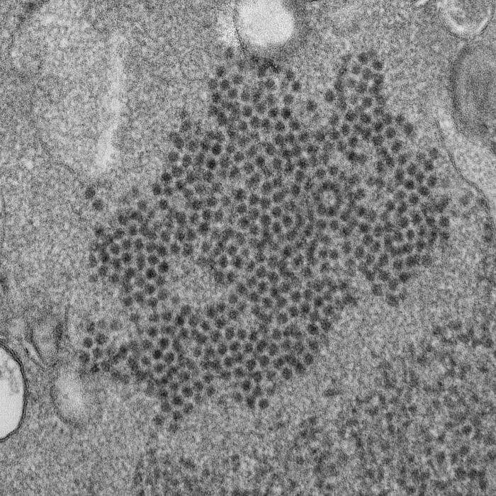 Mysterious respiratory virus hits Midwest, children at highest risk