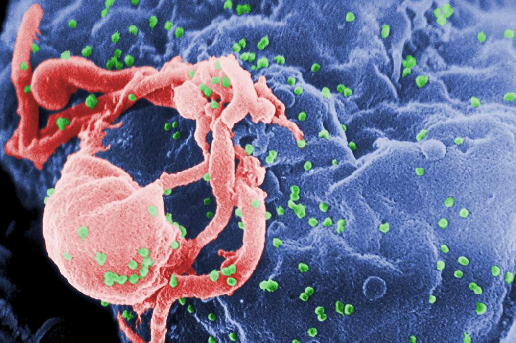 Priming, Shaping And Polishing: In Search Of A HIV Vaccine