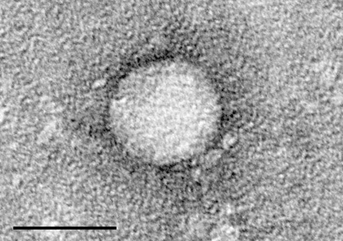 Hepatitis C tests spike after blood scandal news