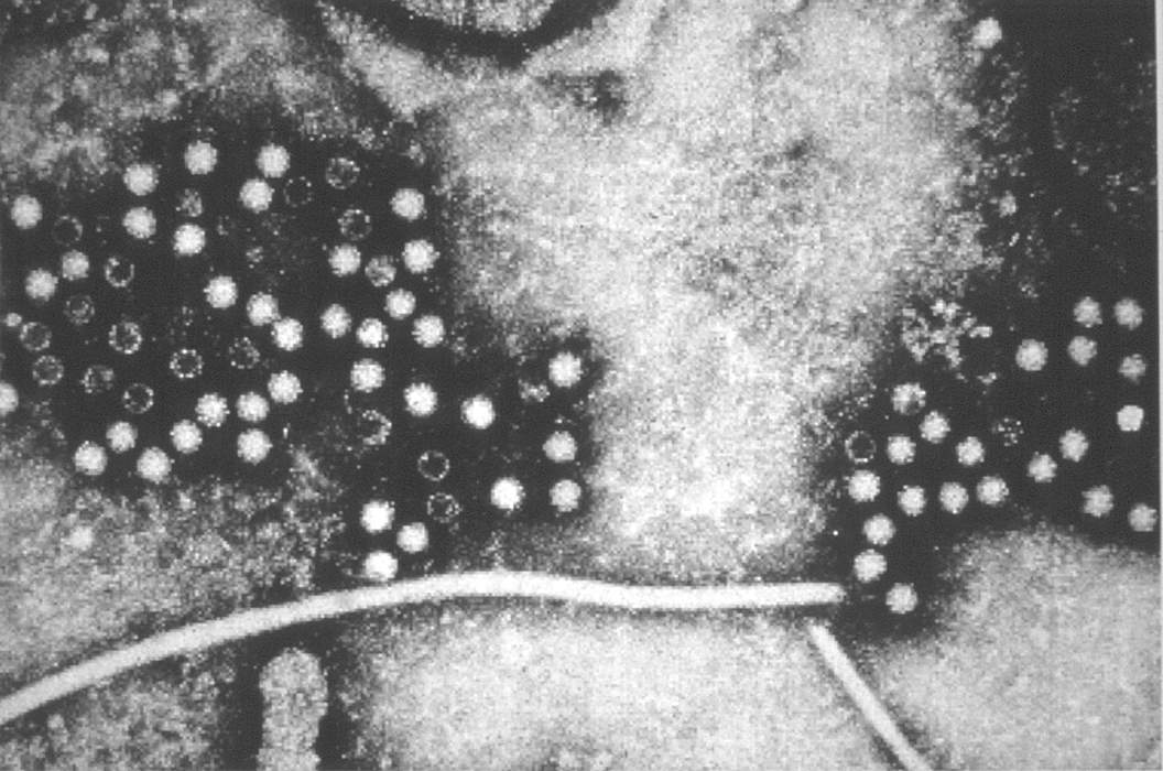 How Hepatitis E Viruses Enter Cells