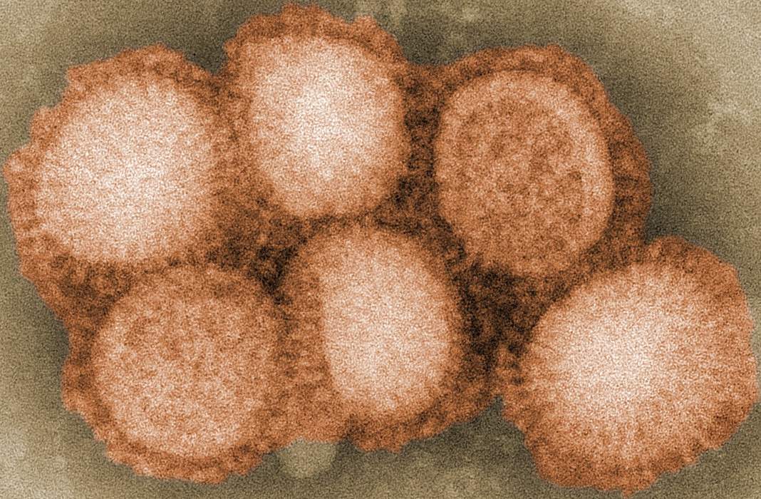 Russia reports world's 1st case of H5N8 bird flu virus in humans