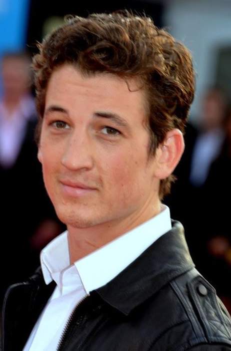 Miles Teller Has Black Eye After Getting Punched in Face on Maui