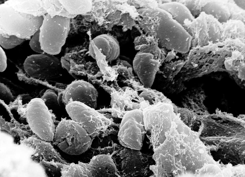 Body Lice May Be Bigger Plague Spreaders Than Previously Thought