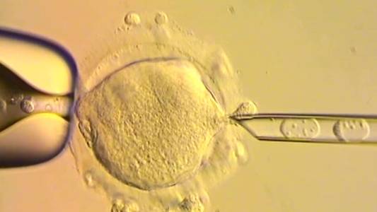 Babies born in UK with DNA from three people to treat inherited disease takes medicine into uncharted territory